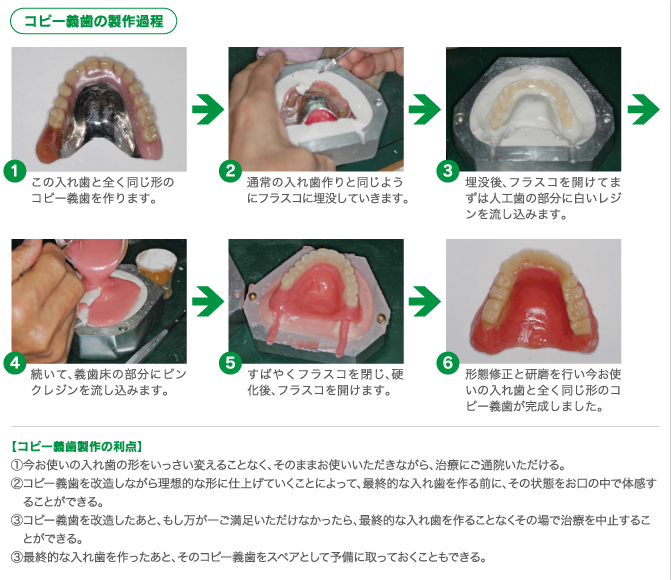 入れ歯 の 調整 の 仕方